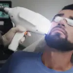 Is Beard Laser Hair Removal Better Than Shaving?