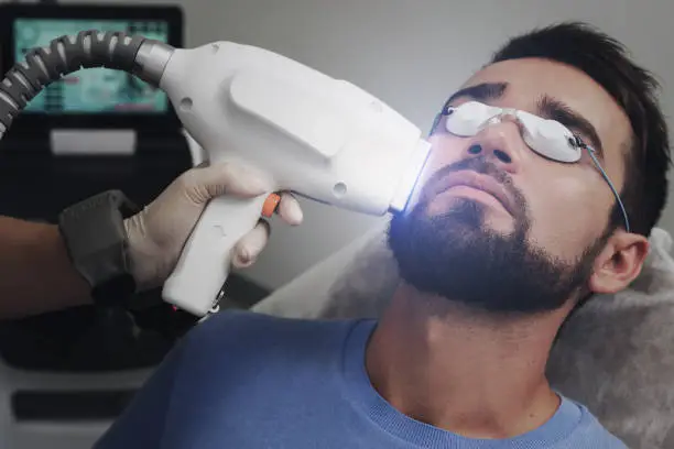 Is Beard Laser Hair Removal Better Than Shaving? Is Beard Laser Hair Removal Better Than Shaving?