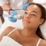 Is Pico Laser Treatment Suitable for All Skin?