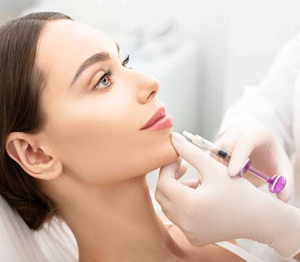 Is Russian Lip Fillers Good for Lip Shape?