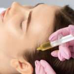 PRP Hair Treatment for Supporting Stronger Hair From the Roots