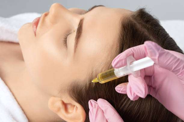 PRP Hair Treatment for Supporting Stronger Hair From the Roots