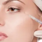 Understanding the Science Behind Sculptra Fillers in Riyadh Results
