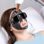 How Spectra Laser Carbon Peeling Helps Improve Skin Texture and Tone