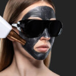 Exploring the Skin Benefits of Spectra Carbon Laser Treatment