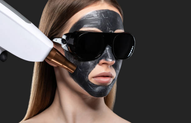 Exploring the Skin Benefits of Spectra Carbon Laser Treatment