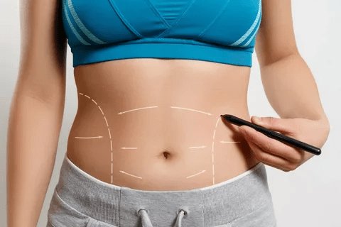 Tummy Tuck in Dubai: Ultimate Guide Tummy Tuck in Dubai: Ultimate Guide