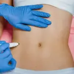 What Can Body Fillers Improve in Your Shape?