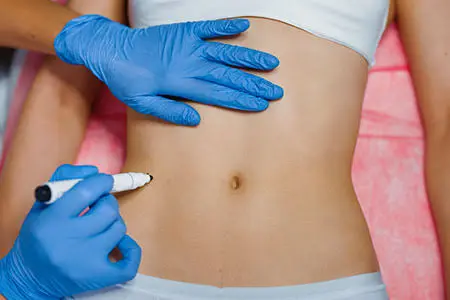 What Can Body Fillers Improve in Your Shape? What Can Body Fillers Improve in Your Shape?