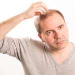 Stem Cell Hair Transplant: Safety Profile and Considerations