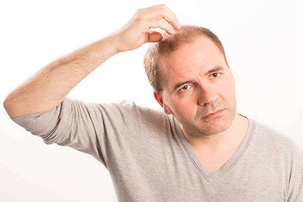 Stem Cell Hair Transplant: Safety Profile and Considerations Stem Cell Hair Transplant: Safety Profile and Considerations