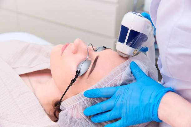 Fractional Laser Treatment for Reducing the Appearance of Common Skin Concerns Fractional Laser Treatment for Reducing the Appearance of Common Skin Concerns