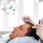 Hair Transplant in Al Ain for Receding Hairlines
