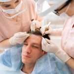 Hair Transplant in Al Ain for Receding Hairlines