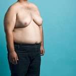 Gynaecomastia in Dubai and Chest Skin Changes