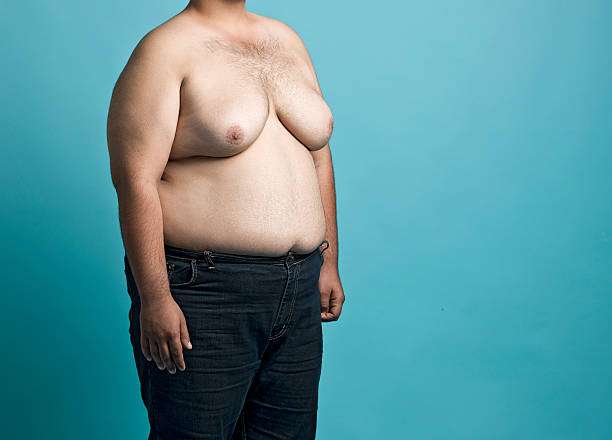 Gynaecomastia in Dubai and Chest Skin Changes Gynaecomastia in Dubai and Chest Skin Changes
