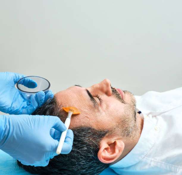 Why Choose Sideburn Hair Transplant in Dubai for Facial Hair Loss Why Choose Sideburn Hair Transplant in Dubai for Facial Hair Loss