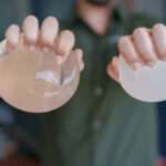 How Modern Silicone Breast Implants Deliver Natural-Looking Results