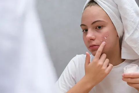 Professional Medicated Facials for Better Skin Health and Personalized Care